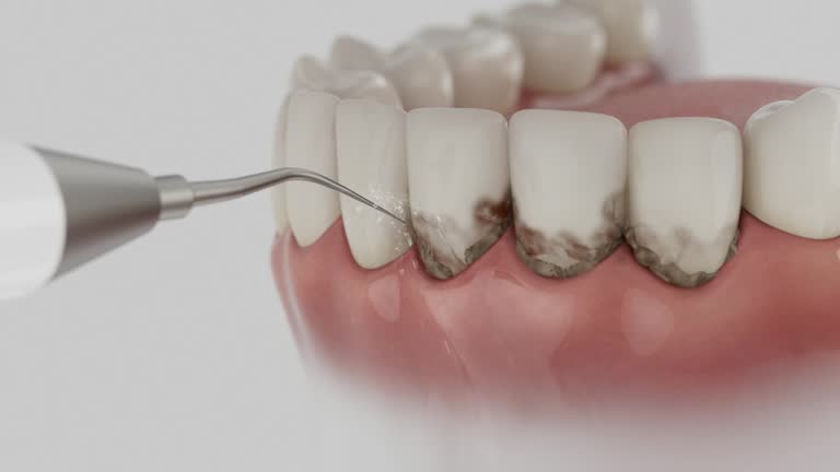 Trusted Dental Implants service in Paw Paw Lake, MI - Dentist Open Now